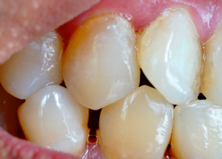 Karbonatı artık raftan indireceksiniz! Öyle marifetleri var ki...