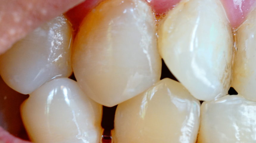 Karbonatı artık raftan indireceksiniz! &Ouml;yle marifetleri var ki...