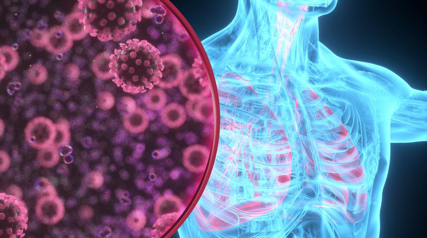 Akciğer kanseri uyarısı: Pandemi d&ouml;neminde artış g&ouml;zleniyor