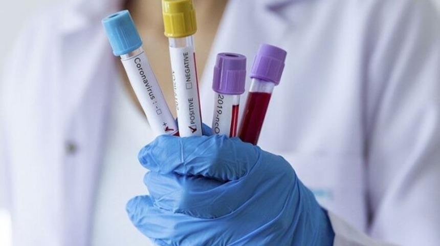 Gençlerbirliği'nde 10 pozitif vaka