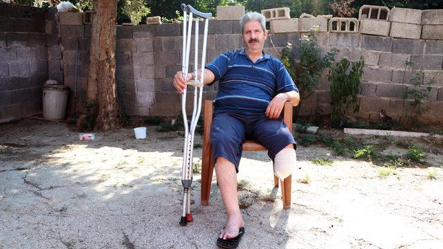 Buerger hastalığından dolayı bacağını kaybetti, gençleri uyardı: Sigarayı bırakın