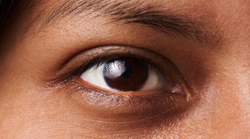 Koyu halkaları ortadan kaldırmanın 6 ucuz yolu! Yoğurt ve gül suyu tarifi...