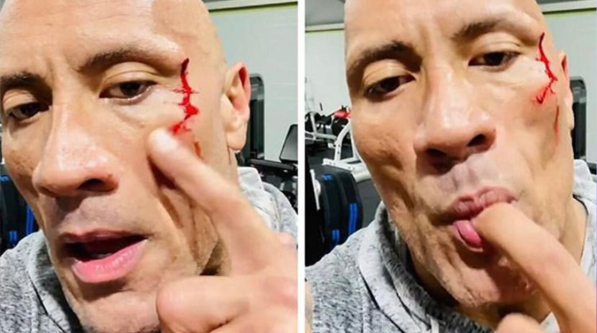 50 kiloluk zincirle kendini yaraladı hiçbir şey olmamış gibi devam etti 