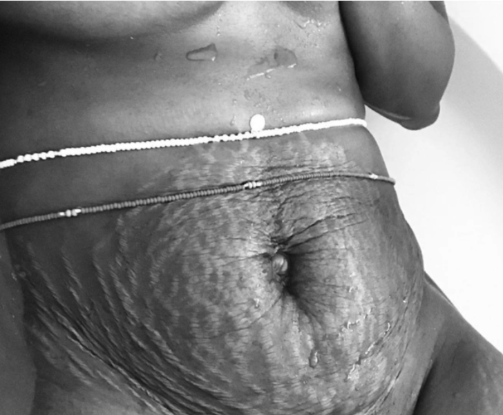 Doğum sonrası vücutlarını paylaşıyorlar! 'Ünlülerden ibaret değil'