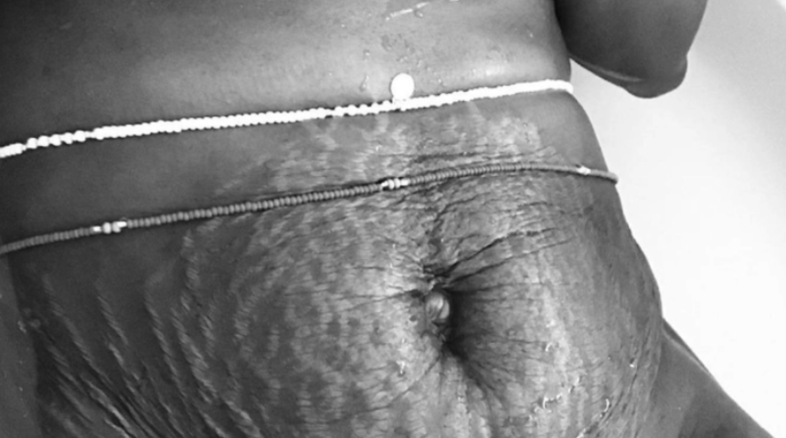 Doğum sonrası v&uuml;cutlarını paylaşıyorlar! '&Uuml;nl&uuml;lerden ibaret değil'