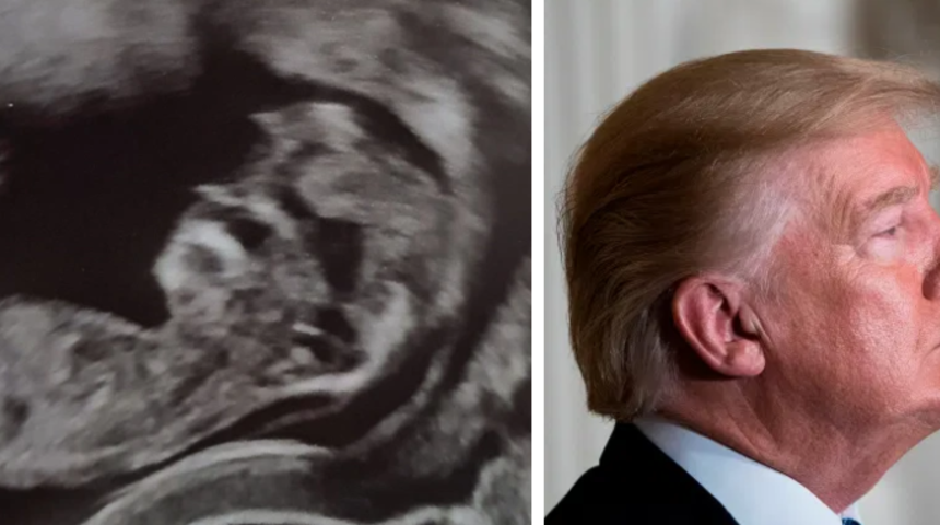 Ultrason g&ouml;r&uuml;nt&uuml;s&uuml;nde bebeğinin Trump&rsquo;a benzediğini g&ouml;ren anne şoka girdi