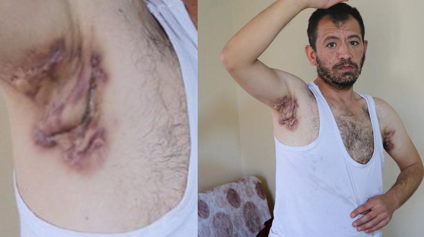 K&ouml;pek memesi hastası yardım bekliyor! 'Eşim bile benden tiksiniyor'