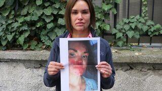 Ankara'da korkunç olay! Güzellik uzmanı, Rus eşini öldüresiye dövdü