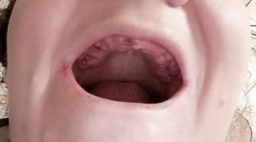 Şaşkına &ccedil;eviren an! Dişlerini fır&ccedil;alarken lavaboya dişleri d&ouml;k&uuml;ld&uuml;