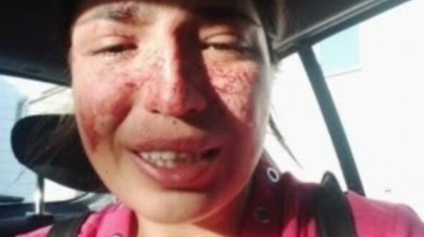 Sibel Aslan y&uuml;z&uuml; kanlı fotoğrafını paylaşarak yardım istedi: Ben &ouml;lmeden sesim olun