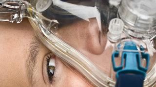 Çocuklarda uyku apnesi nasıl fark edilir? İşte uyku apnesi belirtileri