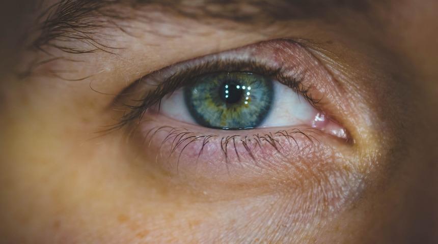 Göz şişliğine ne iyi gelir? Göz şişliği evde nasıl geçer ve neden olur?