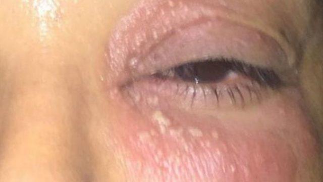 Ünlü şarkıcıyı 10 yıllık eşi bu hale getirdi