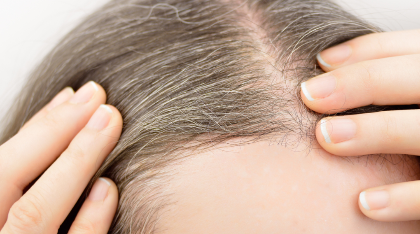 Saçın erken beyazlama sebebi buymuş! Çok fazla abur cubur tüketiyorsanız...