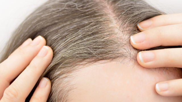 Saçın erken beyazlama sebebi buymuş! Çok fazla abur cubur tüketiyorsanız...