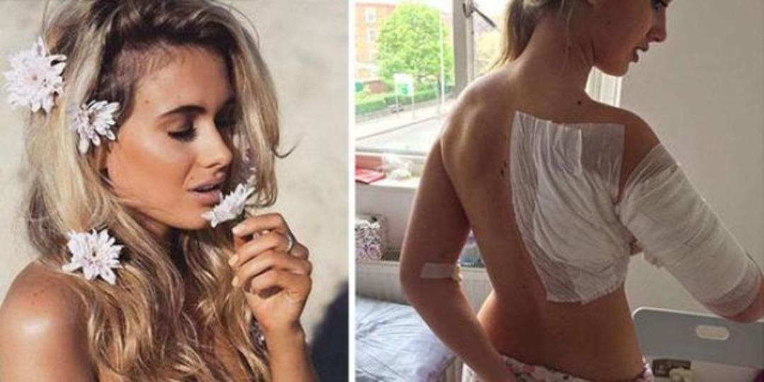 Gece kul&uuml;b&uuml;nde asit dehşeti! Gen&ccedil; model bu hale geldi