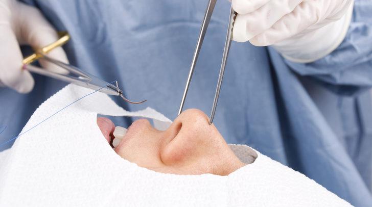 Burun Estetigi Estetik Cerrahi Plastik Cerrah Doc Dr Arzu Akcal