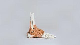 Ayak ağrısına ne iyi gelir? Ayak ağrısı için evde de uygulanabilen mucizevi bitkisel tedavi yöntemleri