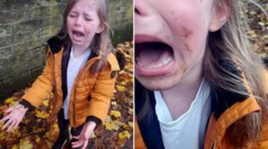 K&ouml;pek dışkısının &uuml;st&uuml;ne y&uuml;z&uuml;st&uuml; d&uuml;şen kız hayatının travmasını yaşadı