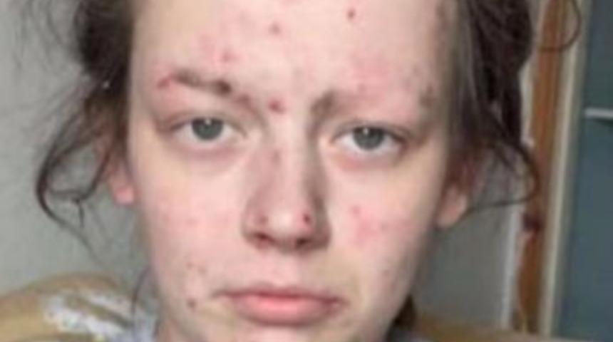 Uyuşturucuyu bırakan kadının inanılmaz değişimi