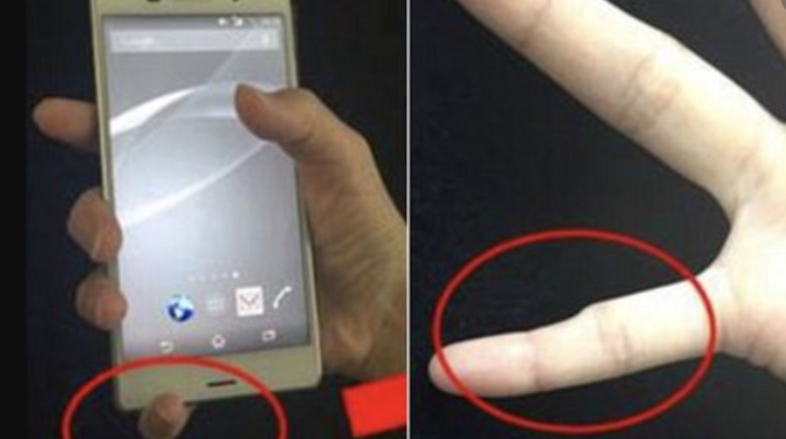 Telefon bağımlılığı y&uuml;z&uuml;nden parmağı '&ccedil;&ouml;kt&uuml;!'