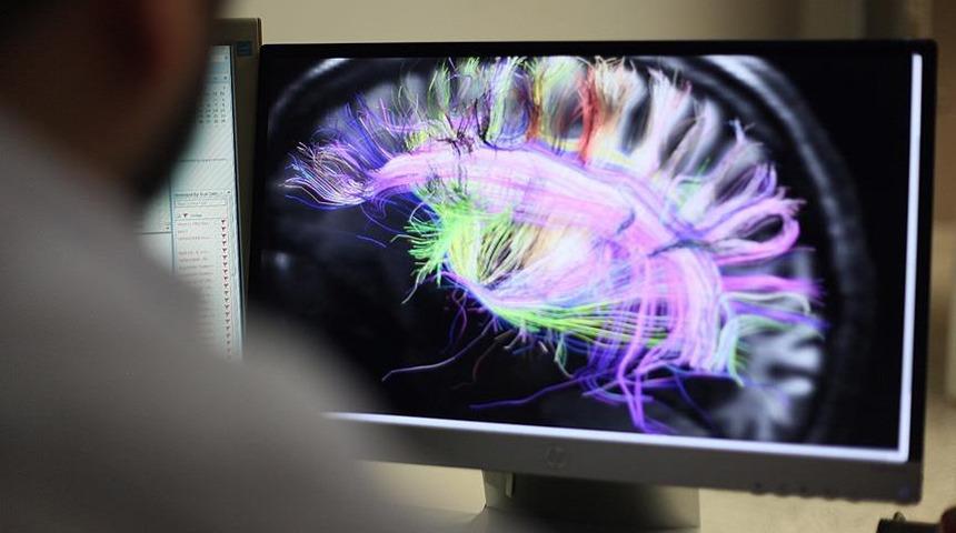 TMS tedavisi nedir? TMS tedavisi nasıl yapılır? 