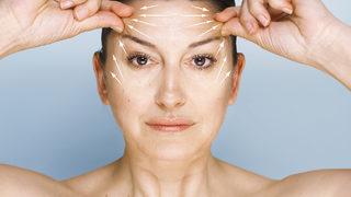 Kalkık kaş ve çekik gözler için toksin uygulaması