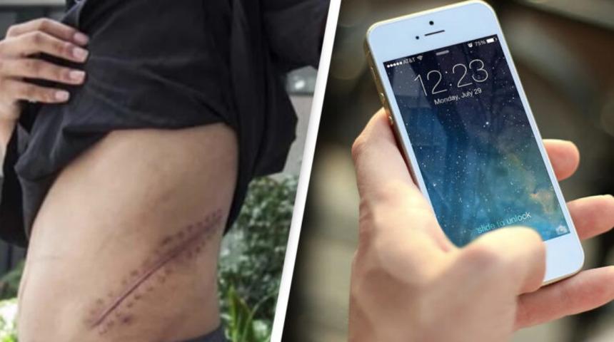 iPhone için böbreğini satan genç yatalak kaldı