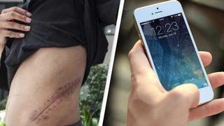 iPhone için böbreğini satan genç yatalak kaldı