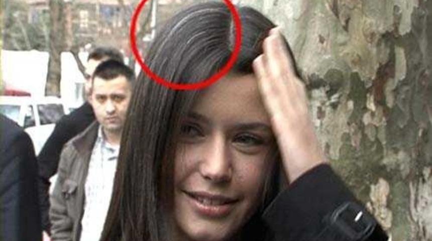 Stresli hayatın kurbanı olan beyaz sa&ccedil;ları yok edecek en etkili &ccedil;&ouml;z&uuml;mler