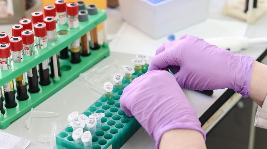 MPV Nedir? MPV Değeri Kaç Olmalıdır? Düşüklüğü ile Yüksekliği Nedenleri ve Belirtileri