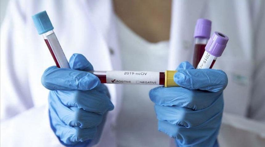 DS&Ouml;, Afrika'da n&uuml;fusun en az y&uuml;zde 20'sine Kovid-19 aşısı yapmayı hedefliyor