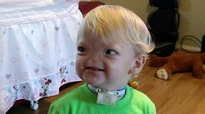 Facebook'tan paylaştığı hik&acirc;yesiyle binlerce insana umut veren burunsuz bebek melek oldu