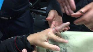 Kangren olacaktı! Kurtarmak için devreye itfaiye ekipleri girdi