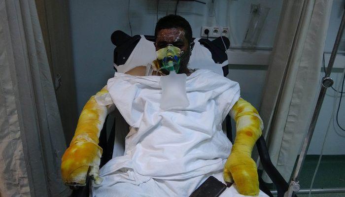 Samsun'da feci olay! Yangında ailesini yanmaktan kurtaran adam yanarak hastanelik oldu