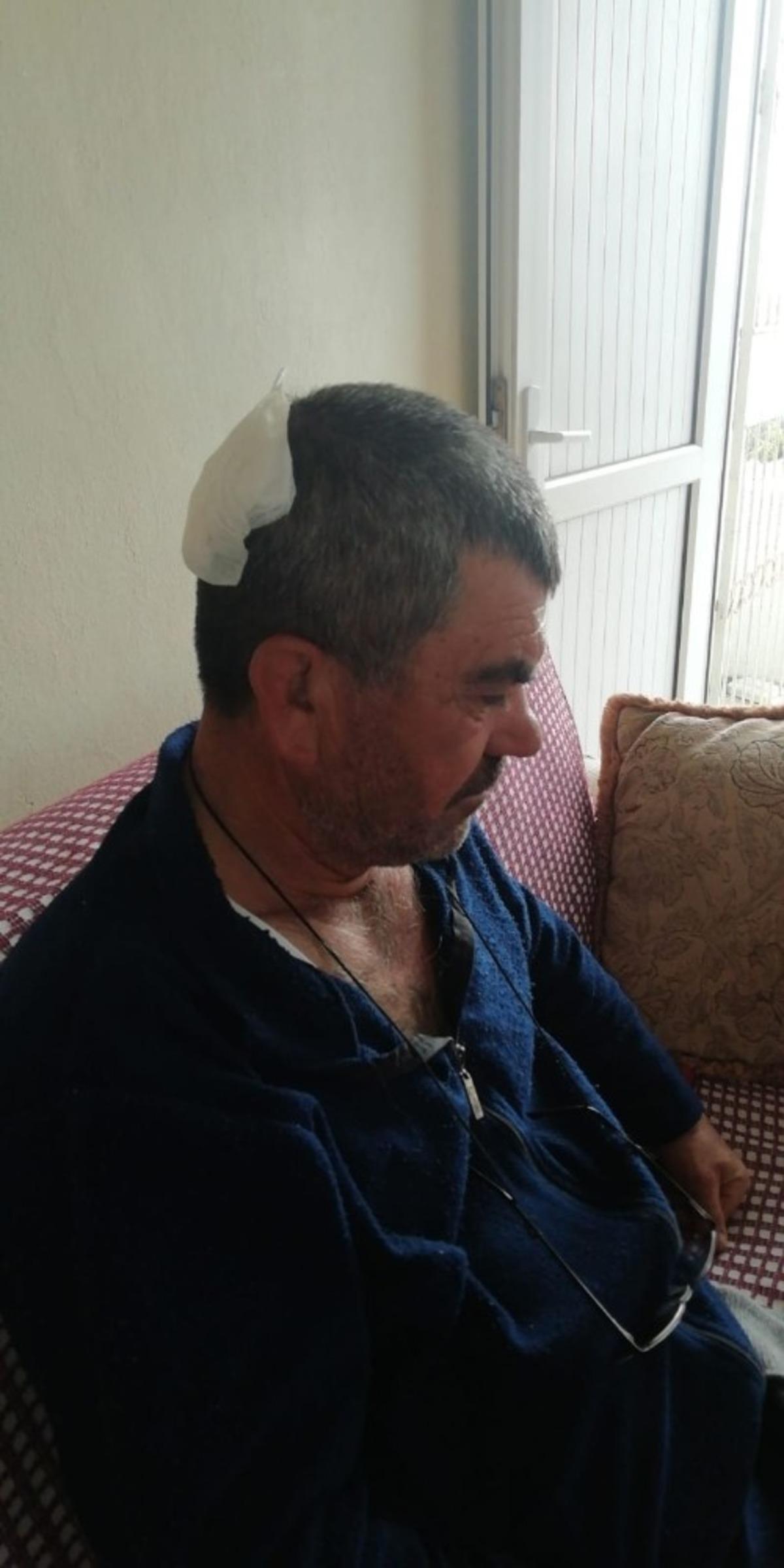 Tarsus&rsquo;ta dinamit patlatılması sonucu 6 kişi yaralandı