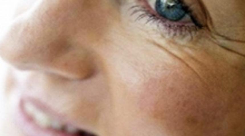 İla&ccedil; Gibi Yiyecekler