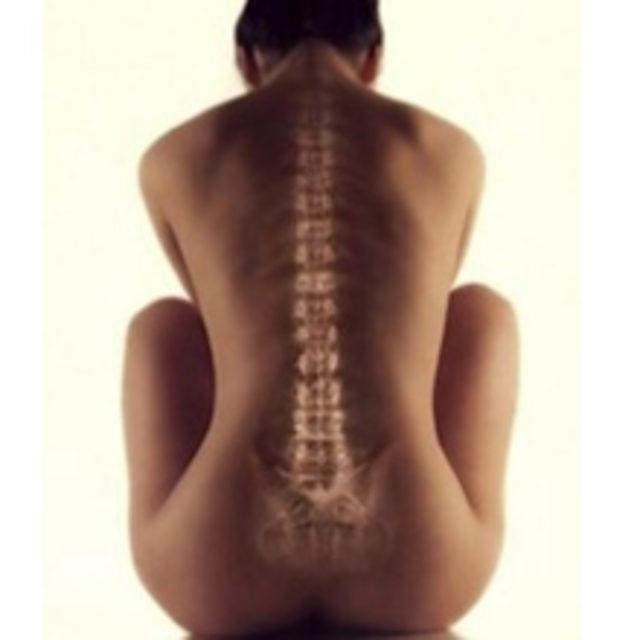 İla&ccedil; Gibi Yiyecekler 9