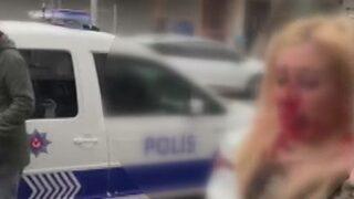 Gaziosmanpaşa'da dehşet! Kadına kafa atıp kanlar içinde bıraktı