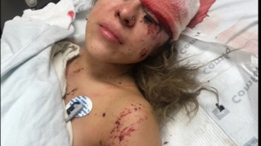 Sanki &uuml;st&uuml;nden minib&uuml;s ge&ccedil;medi! Aklına ilk gelen şeyle şaşkına &ccedil;evirdi