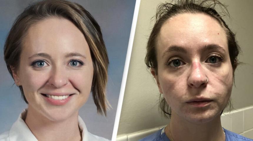 Hemşirenin öncesi - sonrası fotoğrafları şoke etti!