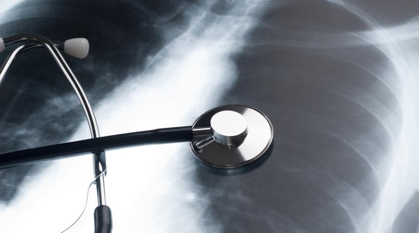 Akciğer tansiyonu olan kişileri uyardı: Covid- 19 daha zorlu geçebilir