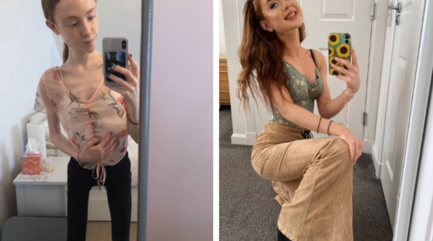 18 yaşında 25 kilo verdi, iki ay yataktan kalkamadı!