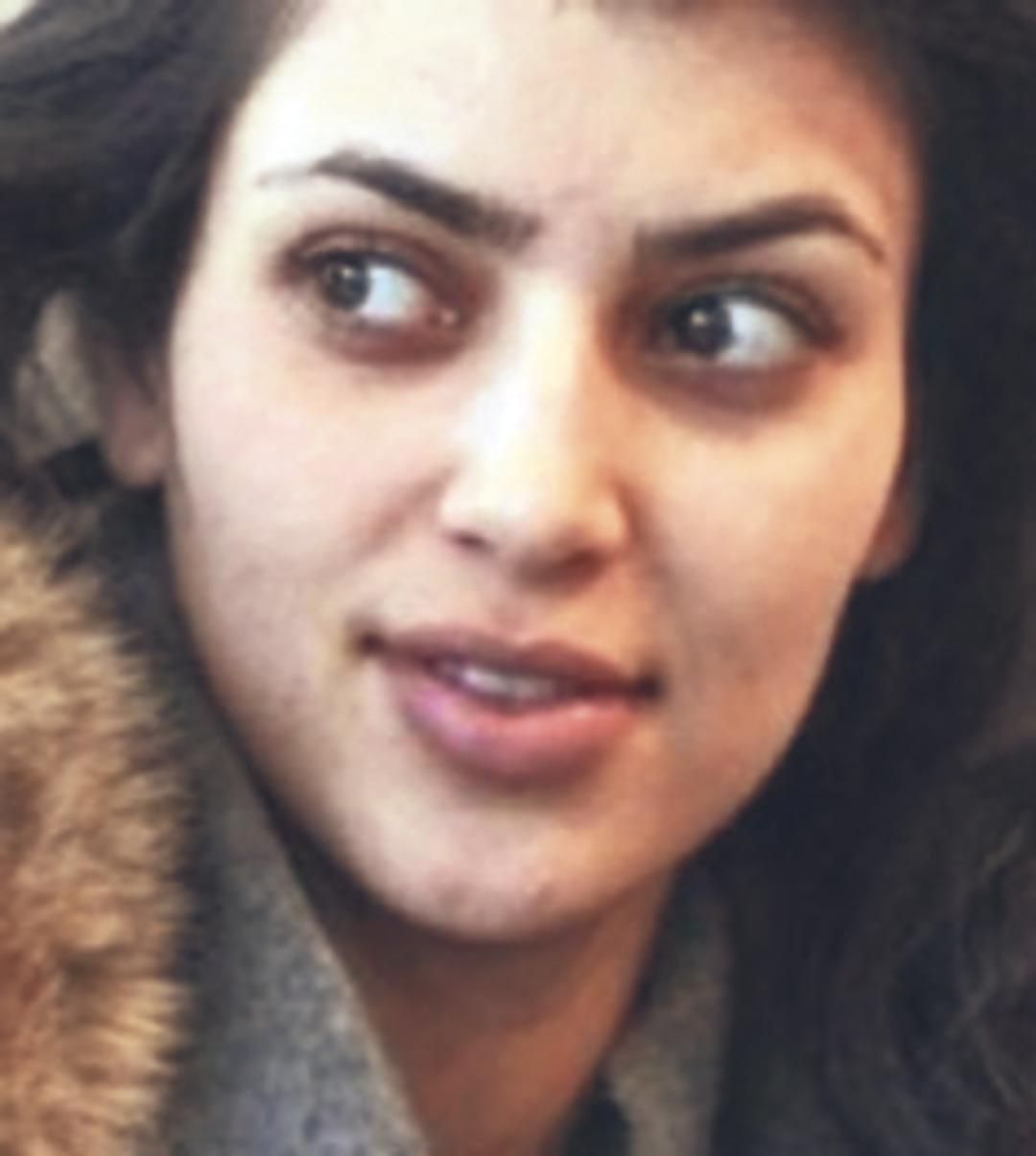 Ünlülerin estetiksiz halleri