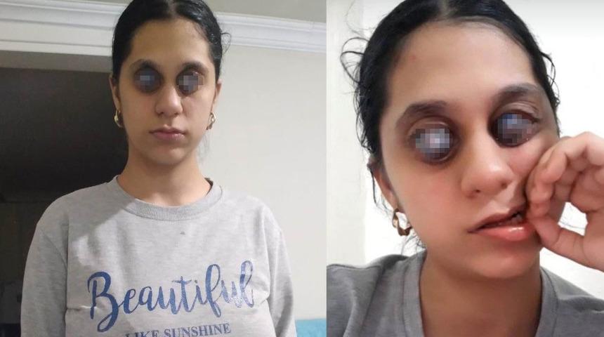 Photoshop sanıyorlar ama gerçek: Genç Ümran’ı görenler gözlerine inanamıyor