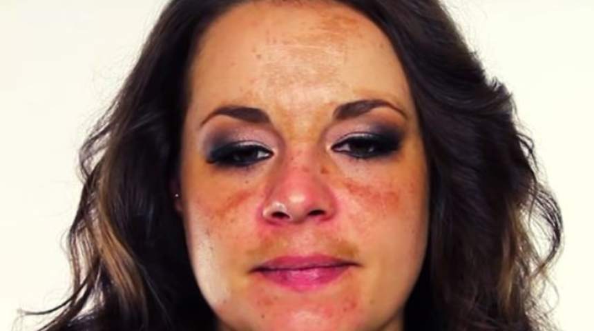 Bıyık bölgesindeki renk değişikliğinden kurtulmanın 3 yolu! 