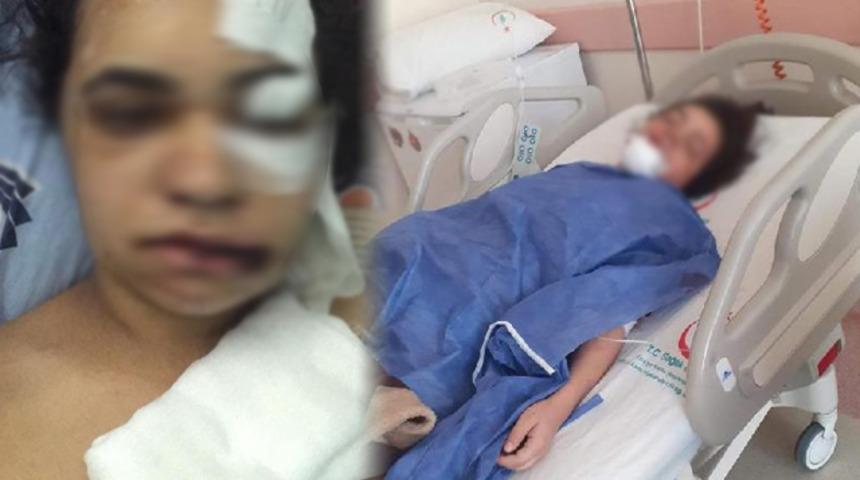 Eşinin dövüp 4'üncü kattan attığı kadın konuştu: Ölseydim, 'intihar etti' diyeceklerdi