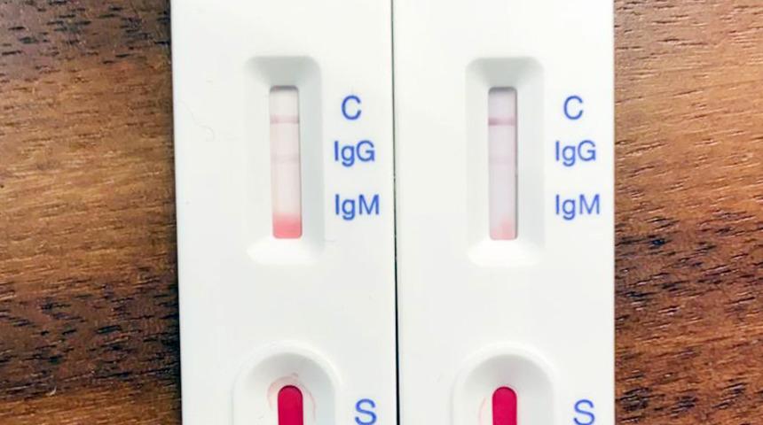 Uzmanlardan evde hızlı koronavirüs testi yapanlara uyarı! 'Kovid teşhisi için kullanılamaz'