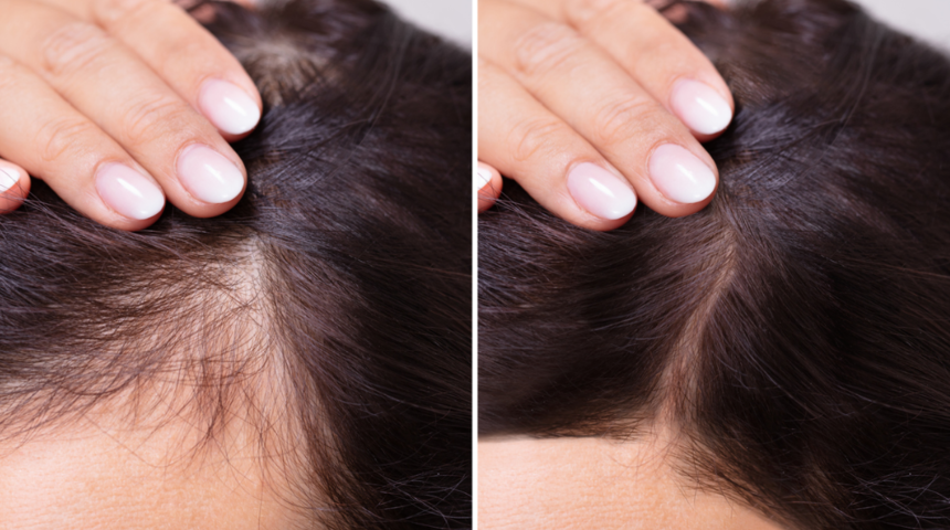 Seyrek sa&ccedil;lılar dikkat! &Uuml;nl&uuml; oyuncular bile bu y&ouml;ntemi kullanıyor