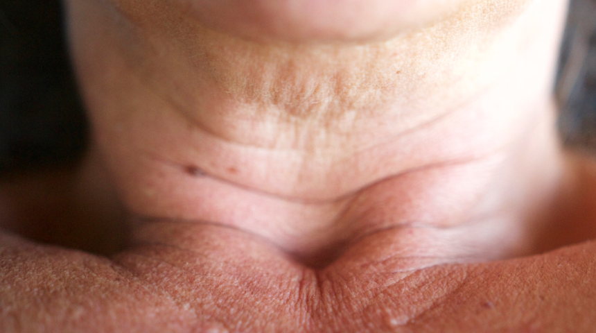 Boyun çizgilerinizi ortadan kaldıracak 5 yöntem! Rahat bir pozisyonda oturun ve...